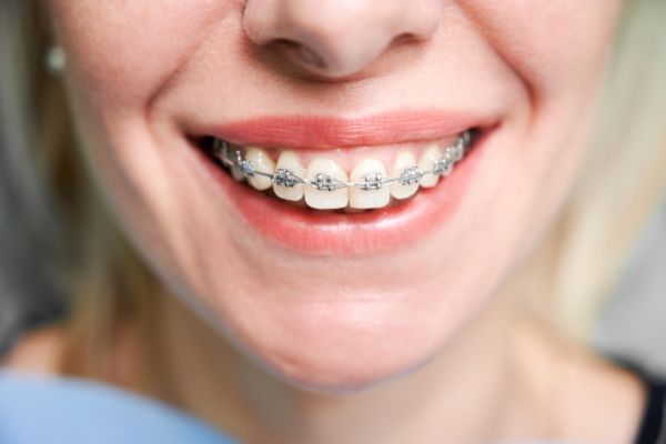 happy young woman in dentist chair
